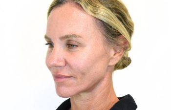 A woman with light hair pulled back and wearing a black shirt looks slightly downward against a plain white background.