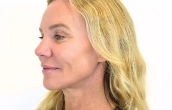 Woman with long blonde hair and light skin is shown in profile view against a plain white background.