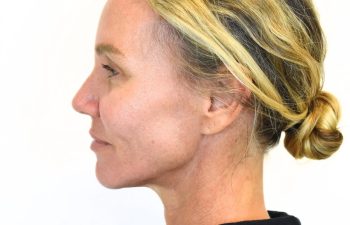 Profile view of a woman with light skin and blonde hair tied in a low bun, wearing a black top, against a plain white background.