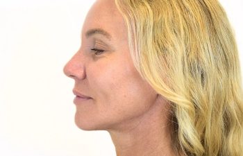 Profile view of a woman with blonde hair and fair skin looking to the left against a plain white background.