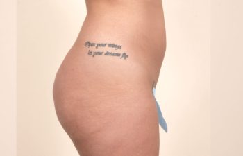 Side view of a person's lower torso with a visible tattoo on the side and wearing minimal blue clothing.