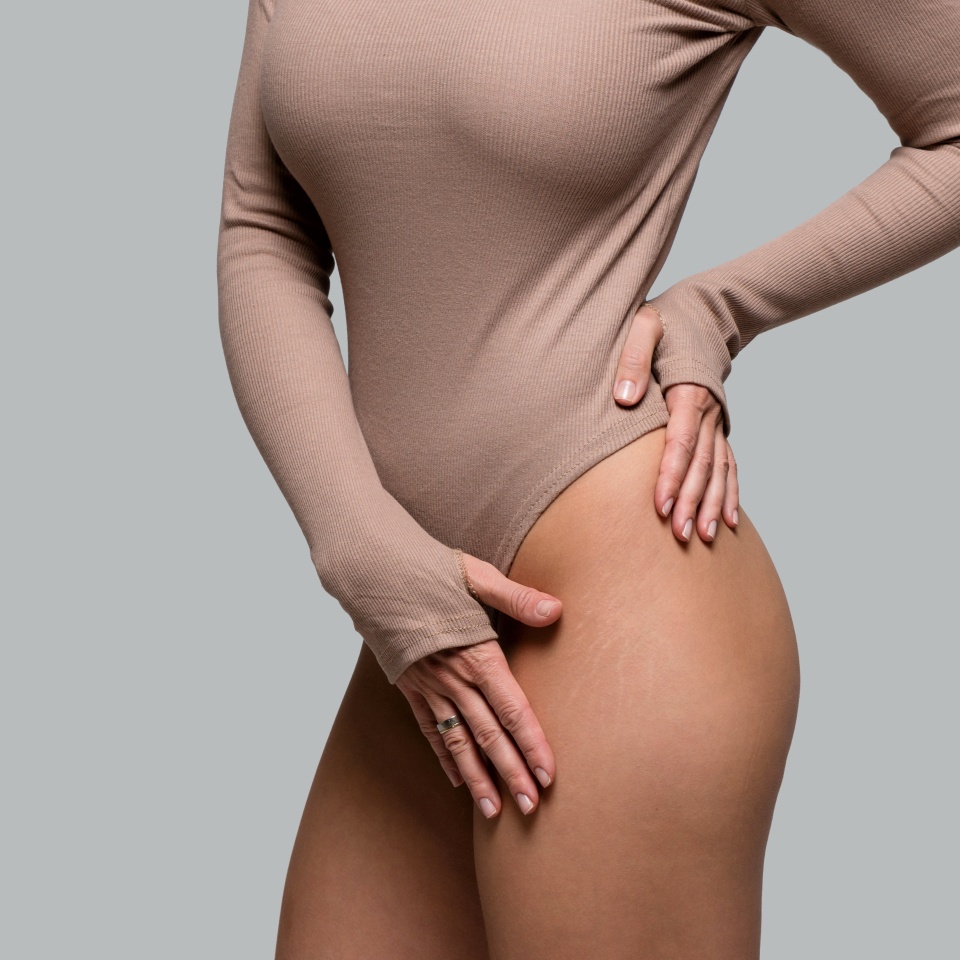 Perfect female figure in a beige bodysuit. Girl is in good shape, has a toned body, healthy skin, slender legs and smooth skin in the bikini area. Stretch marks are visible on the thighs