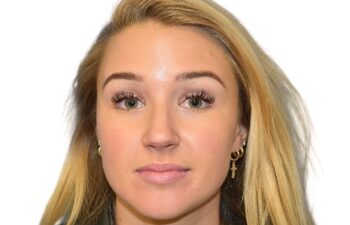 After botox treatment, front view of female patient, Dr. Benjamin Eskenazi at Avabello Aesthetics, Miami Beach.