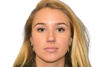 After botox treatment, front view of female patient, Dr. Benjamin Eskenazi at Avabello Aesthetics, Miami Beach.