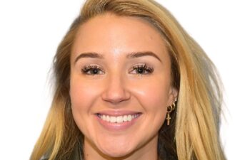 After botox treatment, front view of female patient, Dr. Benjamin Eskenazi at Avabello Aesthetics, Miami Beach.