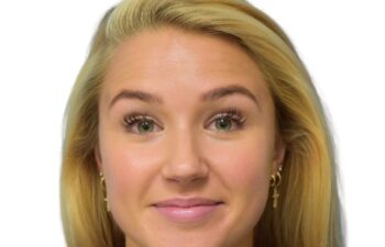 Before botox treatment, front view of female patient, Dr. Benjamin Eskenazi at Avabello Aesthetics, Miami Beach.