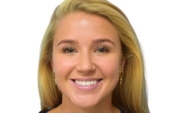 Before botox treatment, front view of female patient, Dr. Benjamin Eskenazi at Avabello Aesthetics, Miami Beach.