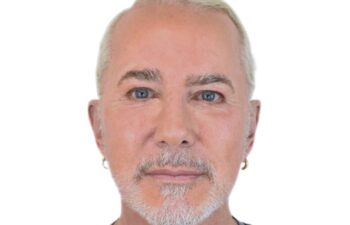 After facelift, front view of a male patient treated by Dr. Benjamin Eskenazi at Avabello Aesthetics in Miami Beach.