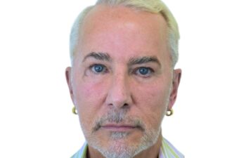 Before facelift, front view of a male patient treated by Dr. Benjamin Eskenazi at Avabello Aesthetics in Miami Beach.