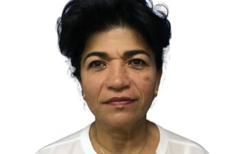 Before facelift, front view of a female patient treated by Dr. Benjamin Eskenazi at Avabello Aesthetics in Miami Beach.