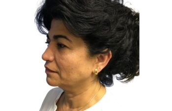 Before facelift, left oblique view of a female patient treated by Dr. Benjamin Eskenazi at Avabello Aesthetics in Miami Beach.