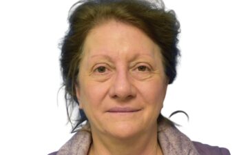 After fat grafting, front view of a female patient treated by Dr. Benjamin Eskenazi at Avabello Aesthetics in Miami Beach.