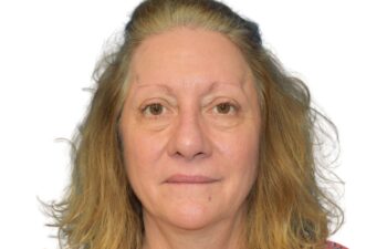 After fat grafting, front view of a female patient treated by Dr. Benjamin Eskenazi at Avabello Aesthetics in Miami Beach.