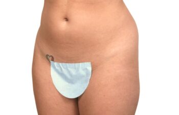 Before liposuction of the abdomen and flanks, left oblique view of a female patient treated by Dr. Benjamin Eskenazi at Avabello Aesthetics