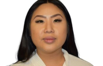 Before submental liposuction, front view of a female patient treated by Dr. Benjamin Eskenazi at Avabello Aesthetics.