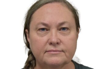 Before upper and lower blepharoplasty, front view of a female patient treated by Dr. Benjamin Eskenazi at Avabello Aesthetics in Miami Beach.