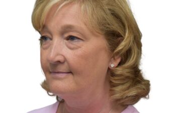 Before upper and lower blepharoplasty, left oblique view of a female patient treated by Dr. Benjamin Eskenazi at Avabello Aesthetics in Miami Beach.